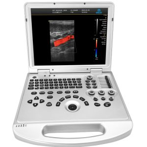 Ecografo veterinario portatile color doppler PRO 15 pollici